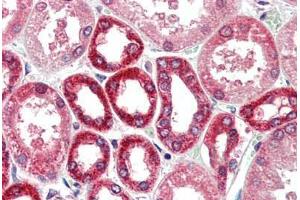 Human Kidney (formalin-fixed, paraffin-embedded) stained with BECN1 antibody ABIN461895 at 5 ug/ml followed by biotinylated goat anti-rabbit IgG secondary antibody ABIN481713, alkaline phosphatase-streptavidin and chromogen. (Beclin 1 Antikörper  (N-Term))