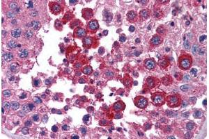 Human Testis (formalin-fixed, paraffin-embedded) stained with STAT4 antibody ABIN239852 at 1:50 followed by biotinylated goat anti-rabbit IgG secondary antibody ABIN481713, alkaline phosphatase-streptavidin and chromogen. (STAT4 Antikörper  (N-Term))