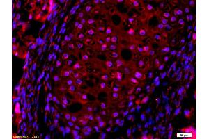 Formalin-fixed and paraffin embedded mouse embryo labeled with Anti-AQP7 Polyclonal Antibody, Unconjugated (ABIN741255) at 1:200, overnight at 4°C, The secondary antibody was Goat Anti-Rabbit IgG, Cy3 conjugated used at 1:200 dilution for 40 minutes at 37°C. (Aquaporin 7 Antikörper  (AA 251-342))