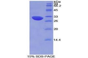 SDS-PAGE analysis of Mouse Complement Factor H Protein. (Complement Factor H Protein (CFH))
