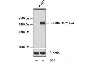 Western blot analysis of extracts from A431 cells using Phospho-GRIN2B(Y1474) Polyclonal Antibody. (GRIN2B Antikörper  (pTyr1474))
