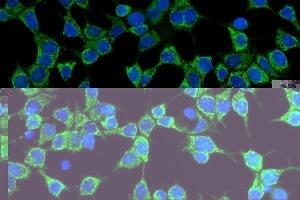 IF analysis of CD86 using anti-CD86 antibody (ABIN7601925).