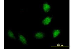 Immunofluorescence of purified MaxPab antibody to TRIM40 on HeLa cell. (TRIM40 Antikörper  (AA 1-258))