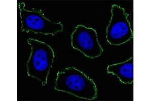 Fluorescent image of A549 cell stained with CD33 antibody at 1:25. (CD33 Antikörper  (AA 337-364))