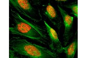 ICC/IF of HeLa cells using recombinant Histone H4 antibody (red).