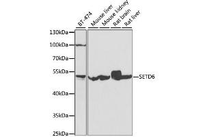 Western blot analysis of extracts of various cell lines, using SETD6 antibody (ABIN4905136) at 1:1000 dilution. (SETD6 Antikörper)