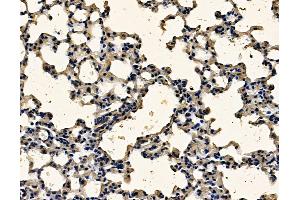 ABIN7097032 and ABIN7101099 at 1/100 staining mouse lung tissue by IHC-P. (SDR16C5 Antikörper)