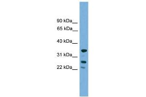 WB Suggested Anti-H1FOO Antibody Titration: 0. (H1FOO Antikörper  (Middle Region))