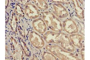 Immunohistochemistry of paraffin-embedded human kidney tissue using ABIN7143187 at dilution of 1:100 (ACAD11 Antikörper  (AA 225-388))