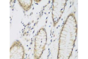 Immunohistochemistry of paraffin-embedded Human stomach using NAT8B Polyclonal Antibody at dilution of 1:200 (40x lens).