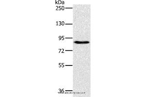 Western blot analysis of 231 cell, using PLEKHG6 Polyclonal Antibody at dilution of 1:800 (PLEKHG6 Antikörper)
