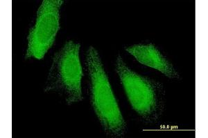 Immunofluorescence of purified MaxPab antibody to UBAP1 on HeLa cell. (UBAP1 Antikörper  (AA 1-502))