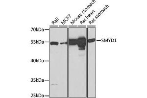 Western blot analysis of extracts of various cell lines, using SMYD1 Antibody (ABIN6128707, ABIN6148163, ABIN6148165 and ABIN6219496) at 1:1000 dilution. (SMYD1 Antikörper  (AA 1-350))