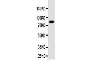 Western Blotting (WB) image for anti-Proprotein Convertase Subtilisin/kexin Type 4 (PCSK4) (AA 117-133), (N-Term) antibody (ABIN3042910)
