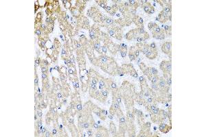 Immunohistochemistry of paraffin-embedded human liver injury using COX5B antibody. (COX5B Antikörper)
