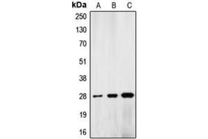 Western blot analysis of Lamin A/C expression in HeLa colchicine-treated (A), mouse liver (B), rat kidney (C) whole cell lysates. (Lamin A/C Antikörper  (Center))