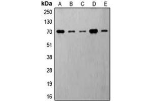 Western blot analysis of S6K1 (pT421) expression in MDAMB231 insulin-treated (A), Jurkat (B), HeLa (C), NIH3T3 (D), PC12 (E) whole cell lysates. (RPS6KB1 Antikörper  (C-Term, pSer421))