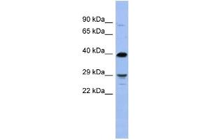WB Suggested Anti-OLIG3 Antibody Titration:  0. (OLIG3 Antikörper  (N-Term))