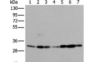 Western blot analysis of 293T Hela Jurkat and A431 cell Human heart tissue Mouse kidney tissue HEPG2 cell lysates using VDAC1 Polyclonal Antibody at dilution of 1:350 (VDAC1 Antikörper)