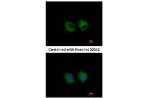 ICC/IF Image Immunofluorescence analysis of methanol-fixed A549, using IL1 Receptor 2, antibody at 1:500 dilution. (IL1R2 Antikörper)