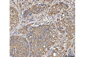 IHC analysis of SUCLG2 using anti-SUCLG2 antibody (ABIN7601694). (SUCLG2 Antikörper  (AA 42-424))