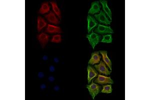 ABIN7094475 and ABIN7098523 staining Hela cells by IF/ICC. (Laminin Antikörper  (N-Term))