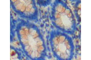 IHC-P analysis of rectum tissue, with DAB staining. (CSN2 Antikörper  (AA 41-198))