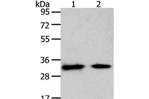 Western Blot analysis of Mouse heart and muscle tissue using SLC25A4 Polyclonal Antibody at dilution of 1:400