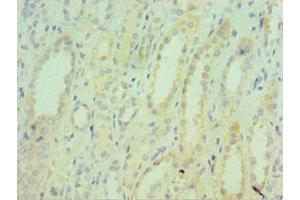 Immunohistochemistry of paraffin-embedded human kidney tissue using ABIN7171754 at dilution of 1:100 (TNXB Antikörper  (AA 3933-4242))