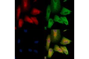 Phospho-WNK1 (Thr60) Antibody staining A549 cells(H2O2 treatment) by IF/ICC. (WNK1 Antikörper  (pThr60))