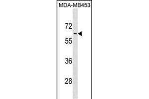 ADRA1B Antibody (C-term) (ABIN1881048 and ABIN2838875) western blot analysis in MDA-M cell line lysates (35 μg/lane).