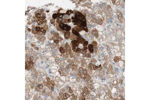 Immunohistochemical staining (Formalin-fixed paraffin-embedded sections) of human adrenal gland with FDFT1 polyclonal antibody  shows strong cytoplasmic positivity in cortical cells. (FDFT1 Antikörper  (AA 10-148))