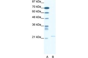 Western Blotting (WB) image for anti-Transient Receptor Potential Cation Channel, Subfamily M, Member 3 (TRPM3) antibody (ABIN2461420) (TRPM3 Antikörper)
