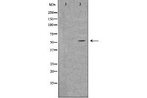 Western blot analysis of extracts from LOVO cells, using SLC30A1 antibody.