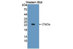 Western blot analysis of the recombinant protein. (IDO Antikörper  (AA 26-199))