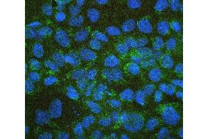 IF analysis of ALDH1A1 using anti-ALDH1A1 antibody (ABIN7602127).