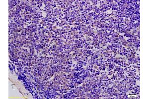 Formalin-fixed and paraffin embedded mouse colon carcinoma labeled with Anti-AMPK beta 1 Polyclonal Antibody, Unconjugated (ABIN737901) at 1:200 followed by conjugation to the secondary antibody and DAB staining. (PRKAB1 Antikörper  (AA 201-270))