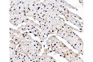 IHC analysis of Rad9/Rad9a using anti-Rad9/Rad9a antibody (ABIN7599342). (RAD9A Antikörper  (AA 1-389))