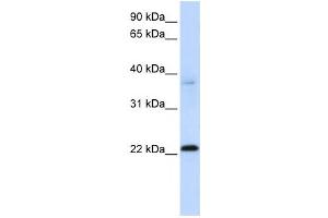Western Blotting (WB) image for anti-Chromosome 11 Open Reading Frame 74 (C11ORF74) antibody (ABIN2459550) (C11ORF74 Antikörper)