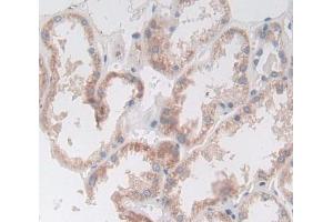 Used in DAB staining on fromalin fixed paraffin- embedded Kidney tissue (Deoxyribonuclease II (AA 19-360) Antikörper)