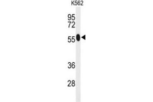 Western Blotting (WB) image for anti-Acyl-CoA Synthetase Medium-Chain Family Member 1 (ACSM1) antibody (ABIN3004114) (ACSM1 Antikörper)