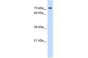 WB Suggested Anti-SLC5A11 Antibody Titration:  0. (Solute Carrier Family 5 (Sodium/inositol Cotransporter), Member 11 (SLC5A11) (Middle Region) Antikörper)
