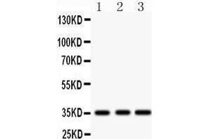 Western Blotting (WB) image for anti-Insulin-Like Growth Factor Binding Protein 2, 36kDa (IGFBP2) (AA 228-257), (C-Term) antibody (ABIN3043858) (IGFBP2 Antikörper  (C-Term))