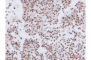 IHC analysis of NRF1 using anti-NRF1 antibody (ABIN7600874). (NRF1 Antikörper  (AA 246-503))