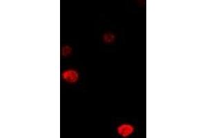 Immunofluorescent analysis of DCK staining in MCF7 cells.