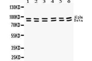 Western Blotting (WB) image for anti-Signal Transducer and Activator of Transcription 1, 91kDa (STAT1) (AA 114-143), (N-Term) antibody (ABIN3043938) (STAT1 Antikörper  (N-Term))
