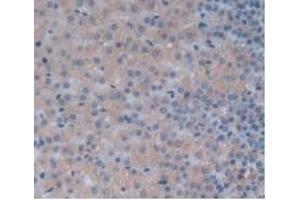Detection of IL24 in Rat Adrenal Gland Tissue using Monoclonal Antibody to Interleukin 24 (IL24) (IL-24 Antikörper  (AA 29-183))
