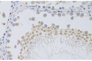 Immunohistochemistry of paraffin-embedded Rat testis using PHC1 Polyclonal Antibody at dilution of 1:100 (40x lens). (PHC1 Antikörper)