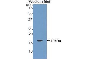 Western blot analysis of the recombinant protein. (TGFB1 Antikörper  (AA 279-390))