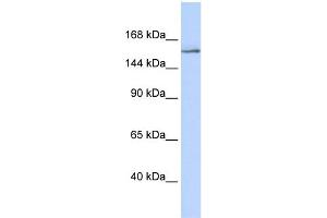 WB Suggested Anti-NCOA3 Antibody Titration:  0. (NCOA3 Antikörper  (Middle Region))